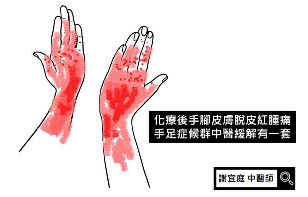 手足症候群 中醫 乳癌化療副作用 中醫婦科 謝宜庭