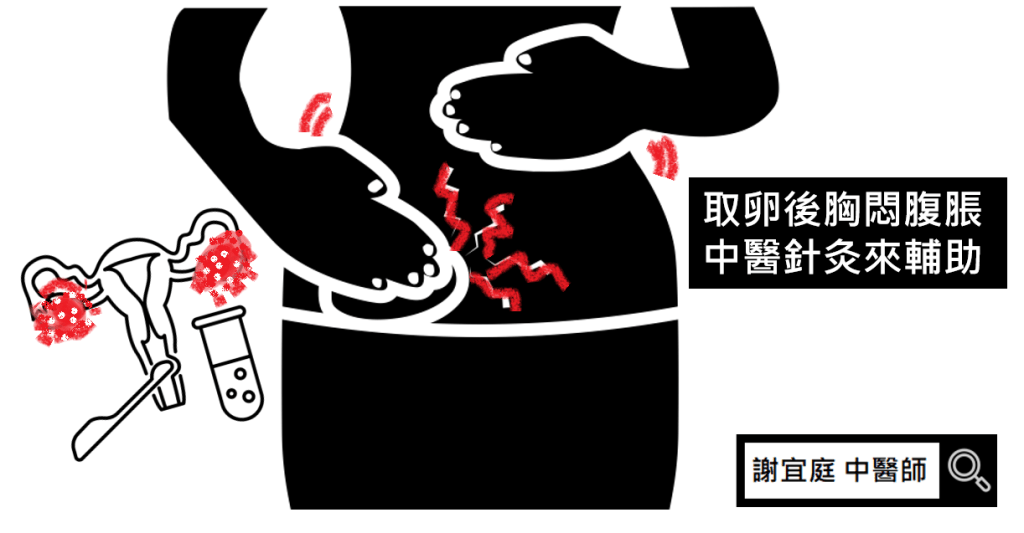 取卵手術 胸悶 腹脹 中醫 針灸